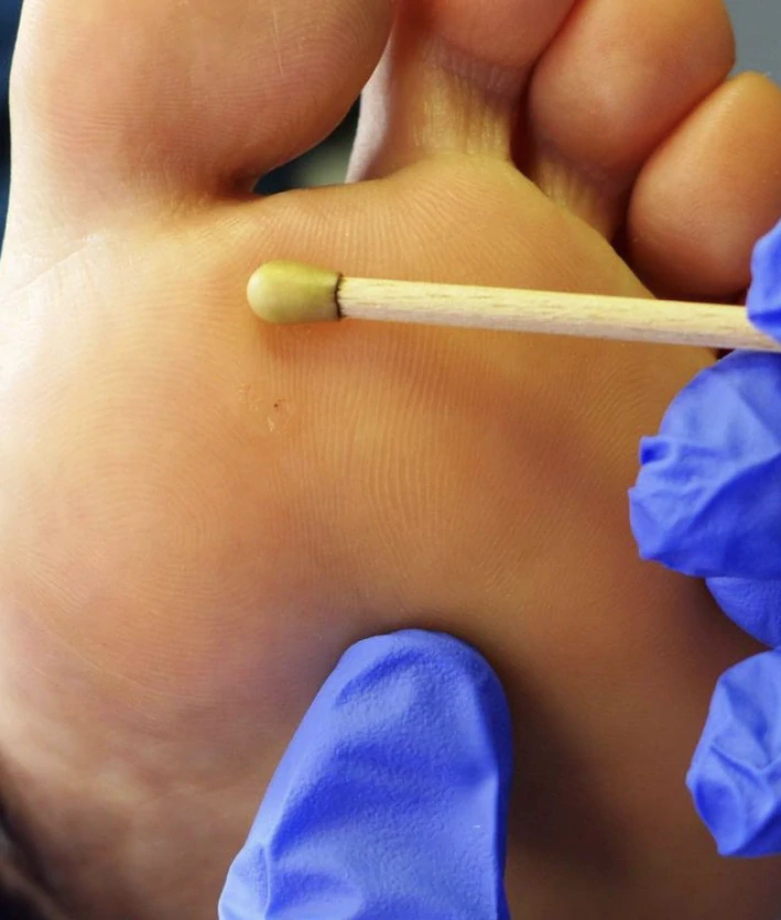 SILVERIN® STICKS, 50%, 100 ks