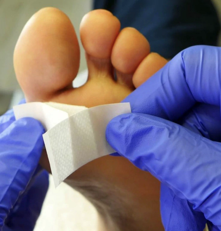 SILVERIN® STICKS, 75%, 10 ks